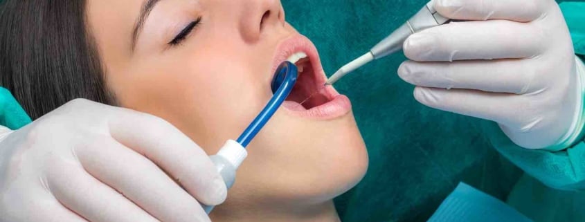dental injuries